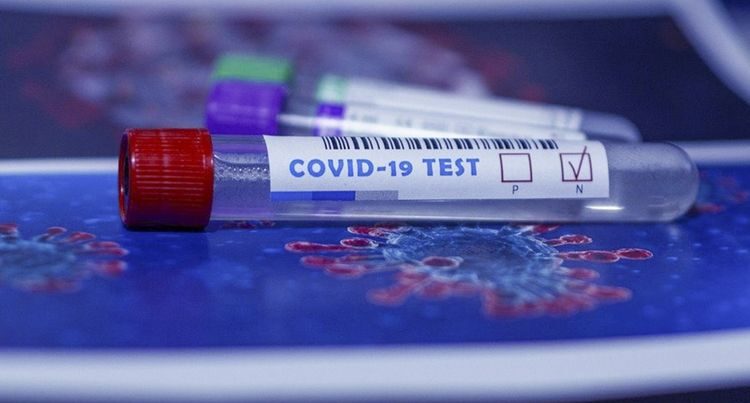 Azərbaycanda koronavirusa yoluxanların sayı azaldı, 2 nəfər öldü