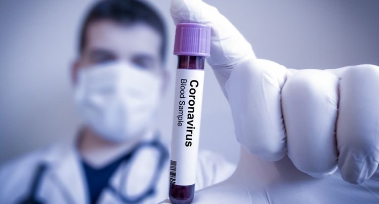 Koronavirus testi müsbət çıxan insanlara 1570 dollar ödəniləcək
