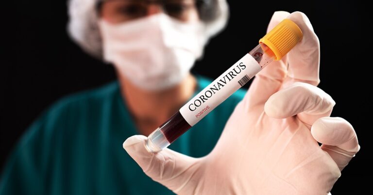 Dünyada koronavirusa yoluxanların sayı 22 milyonu keçdi