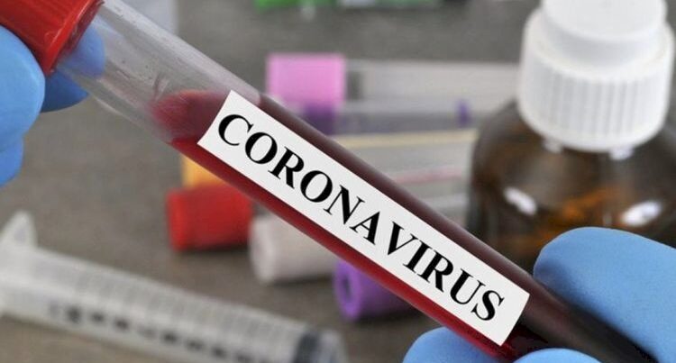 Azərbaycanda son sutkada 963 nəfər koronavirusa yoluxdu