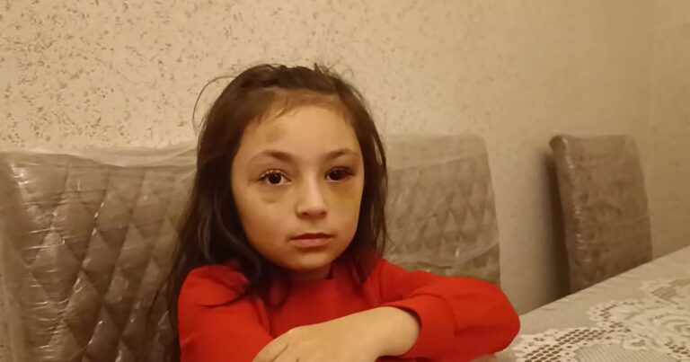 “Direktor maddiyyatla həll etmək istəyirdi” – Döyüldüyü deyilən məktəblinin ANASI + VİDEO