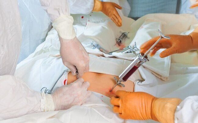 Sümük iliyi köçürməsi tibbi sığorta ilə mümkün olacaq