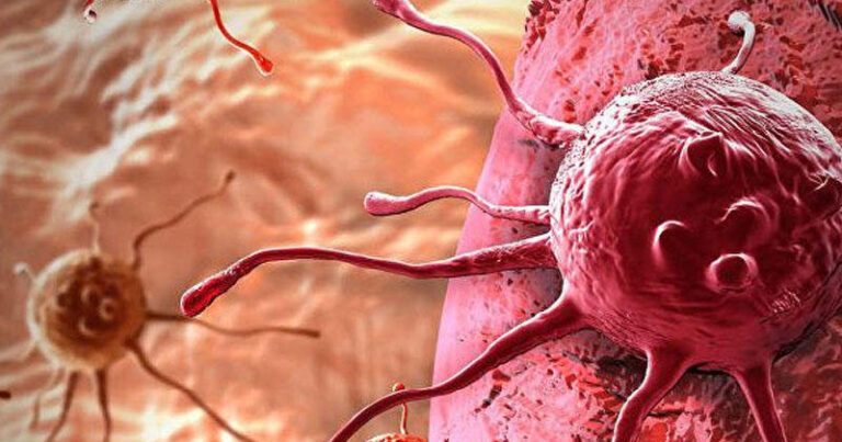 DST xərçənglə bağlı xəbərdarlıq etdi: “Diqqətli olun”