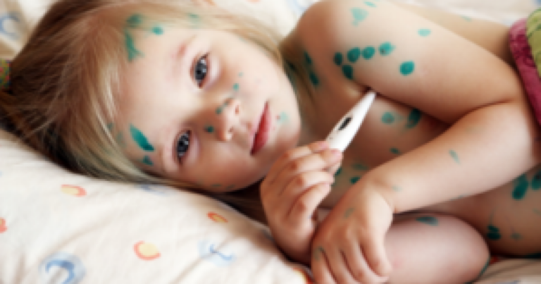 Su çiçəyinə yoluxma ARTIB